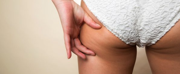 あなたのその行動一つで変わるセルライトになる人とならない人の差
